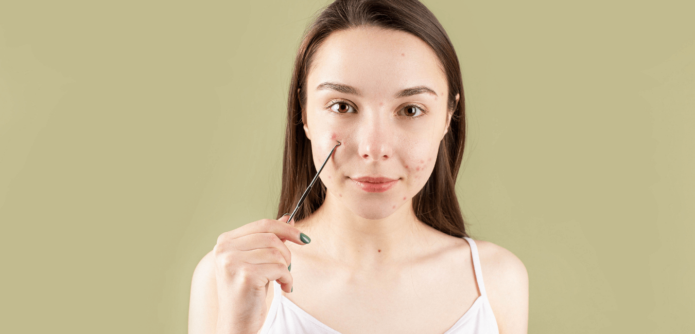 Best Acne Scars Treatment