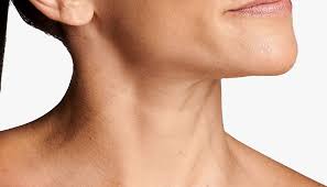 How to tighten neck skin